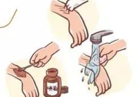 【急診第一線】武寧縣人民醫院急診科成功救治一名毒蛇咬傷患者