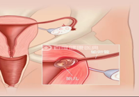 【讓黨放心（xīn） 人民滿意】武寧縣人民醫院新技術（shù）、新項目展播（十四）