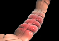 【健康科普】武寧縣人民醫院體檢保（bǎo）健科：吃飯有這3個習慣（guàn），可能會被癌症“盯上”！