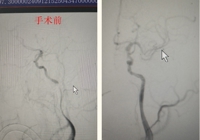 【生命綠（lǜ）色通道】武寧縣總醫（yī）院人民（mín）醫院院區卒中中心