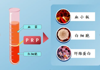【新技術】武寧縣（xiàn）總醫院人民醫院院區骨科：富血（xuè）小板血漿（PRP）注射療法